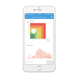 iHealth VIEW BP7s chytrý zápěstní měřič krevního tlaku